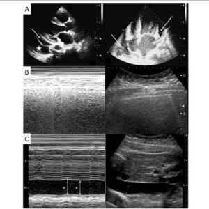 Toshiba/Cannon AplioMx Ultrasound Machine